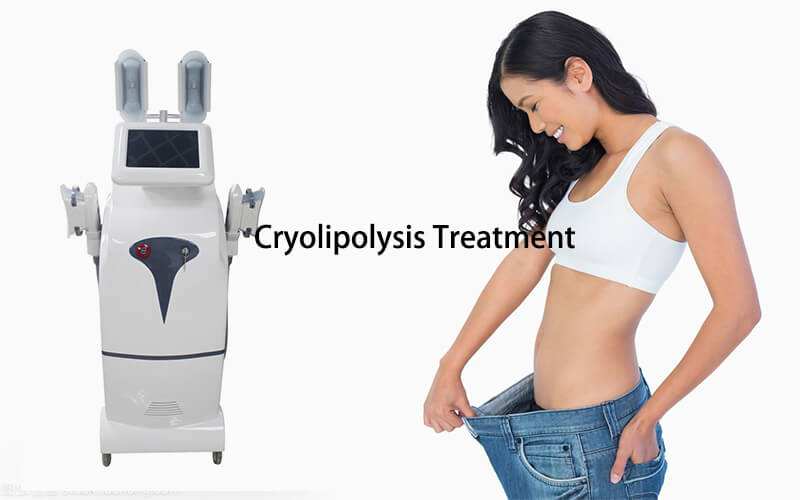 Cryolipolysis reviews