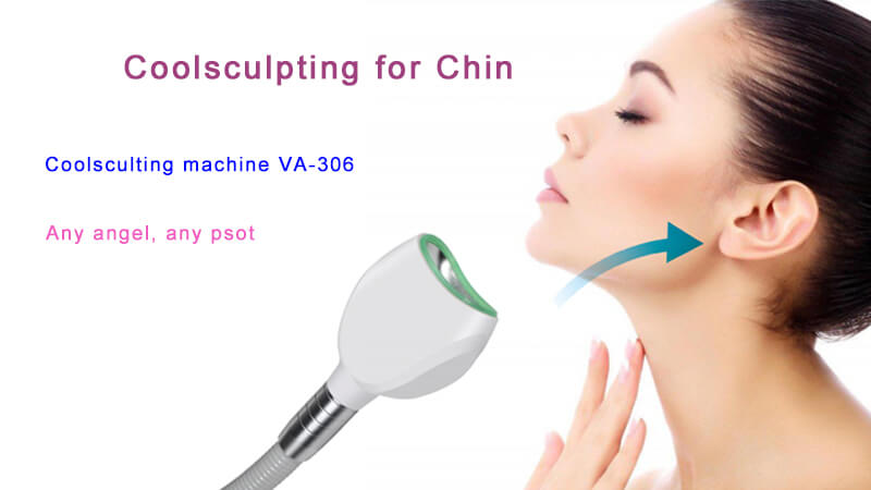coolsculpting chin double chin